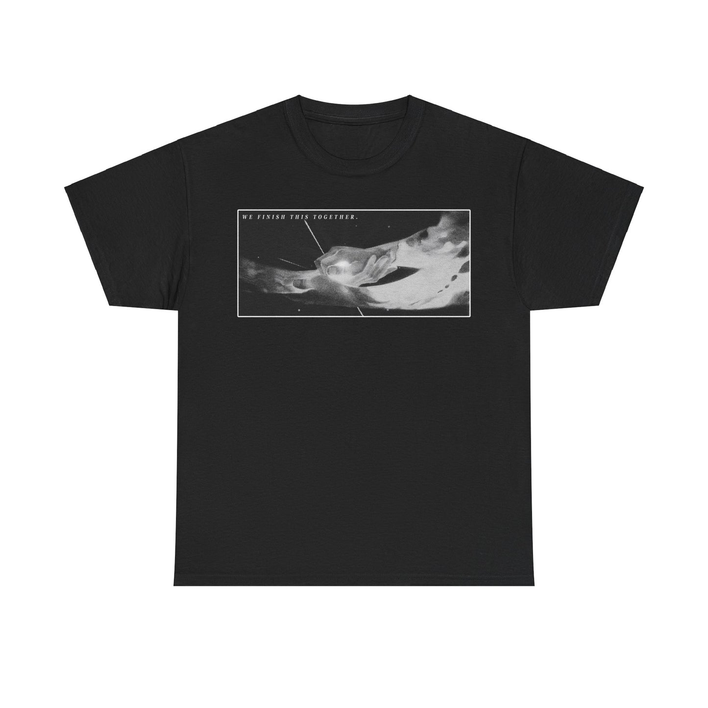 🔴 UK - Hands | 3XL - 5XL